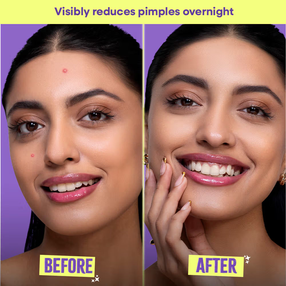 Patchs anti-imperfections et anti-acné Nykaa Skin Goodbye Blemish - 20 pièces