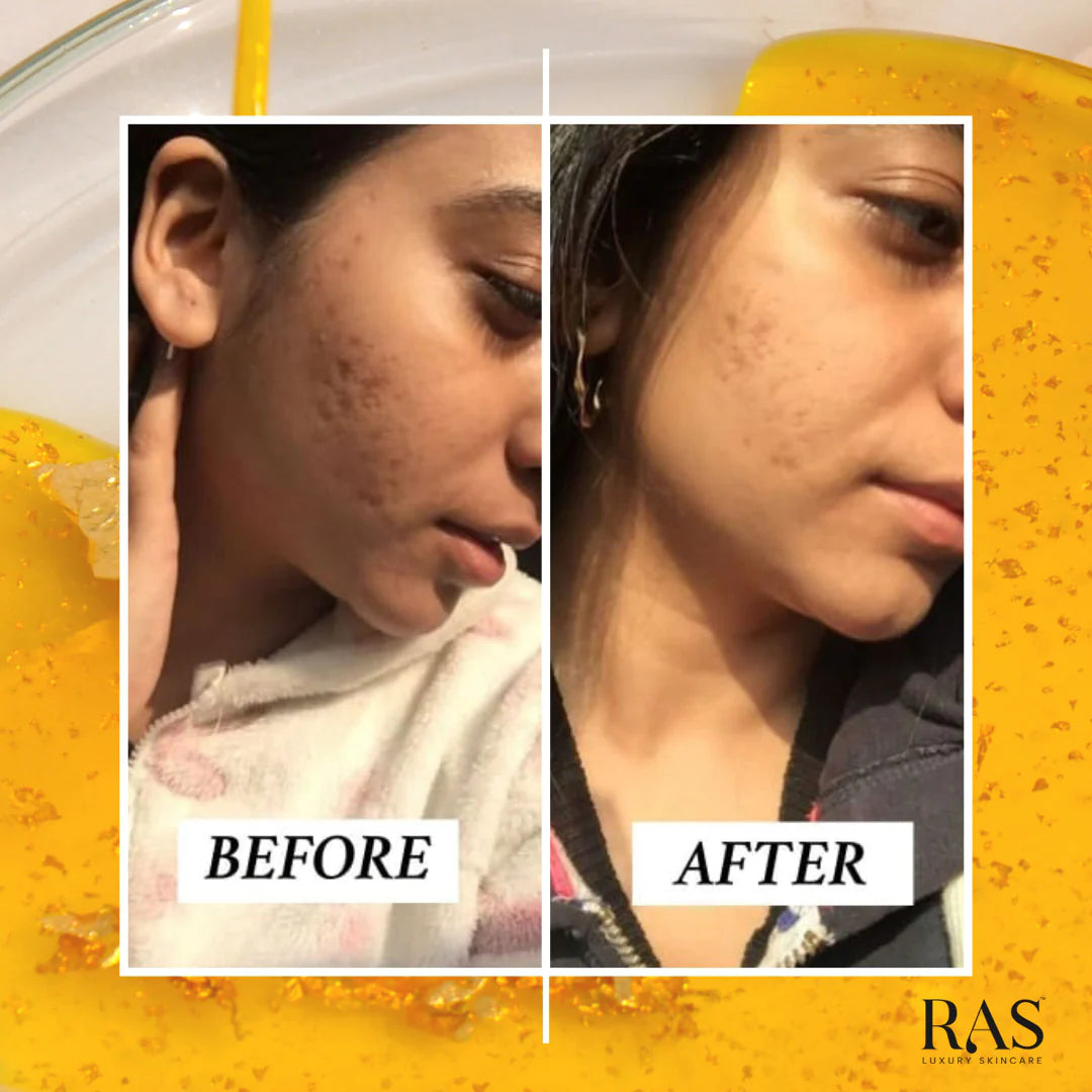 RAS Luxury Oils 24K Gold Radiance Beauty Boosting Face Elixir - 15ml