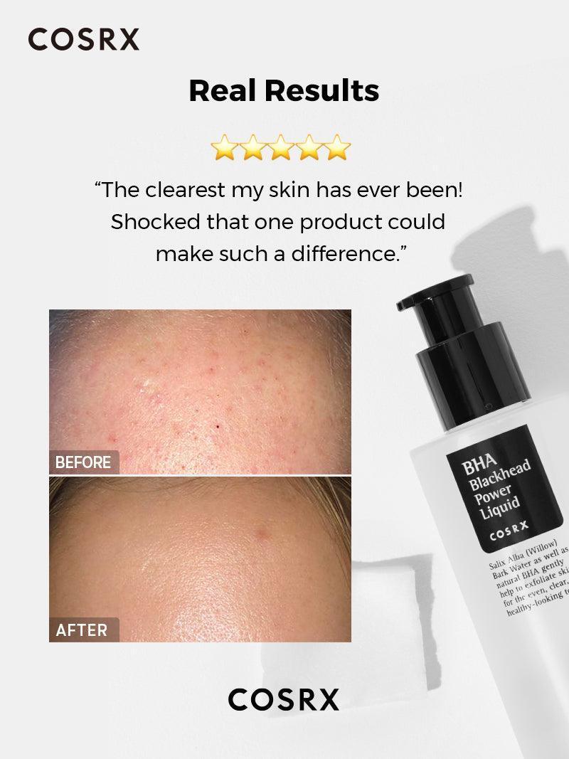 COSRX BHA Blackhead Power Liquid - 100ml