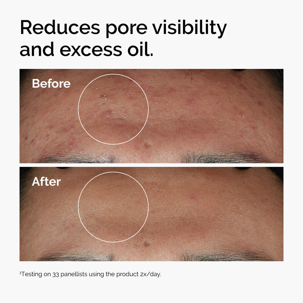 The Ordinary Niacinamide 10% + Zinc 1% Haute Concentration