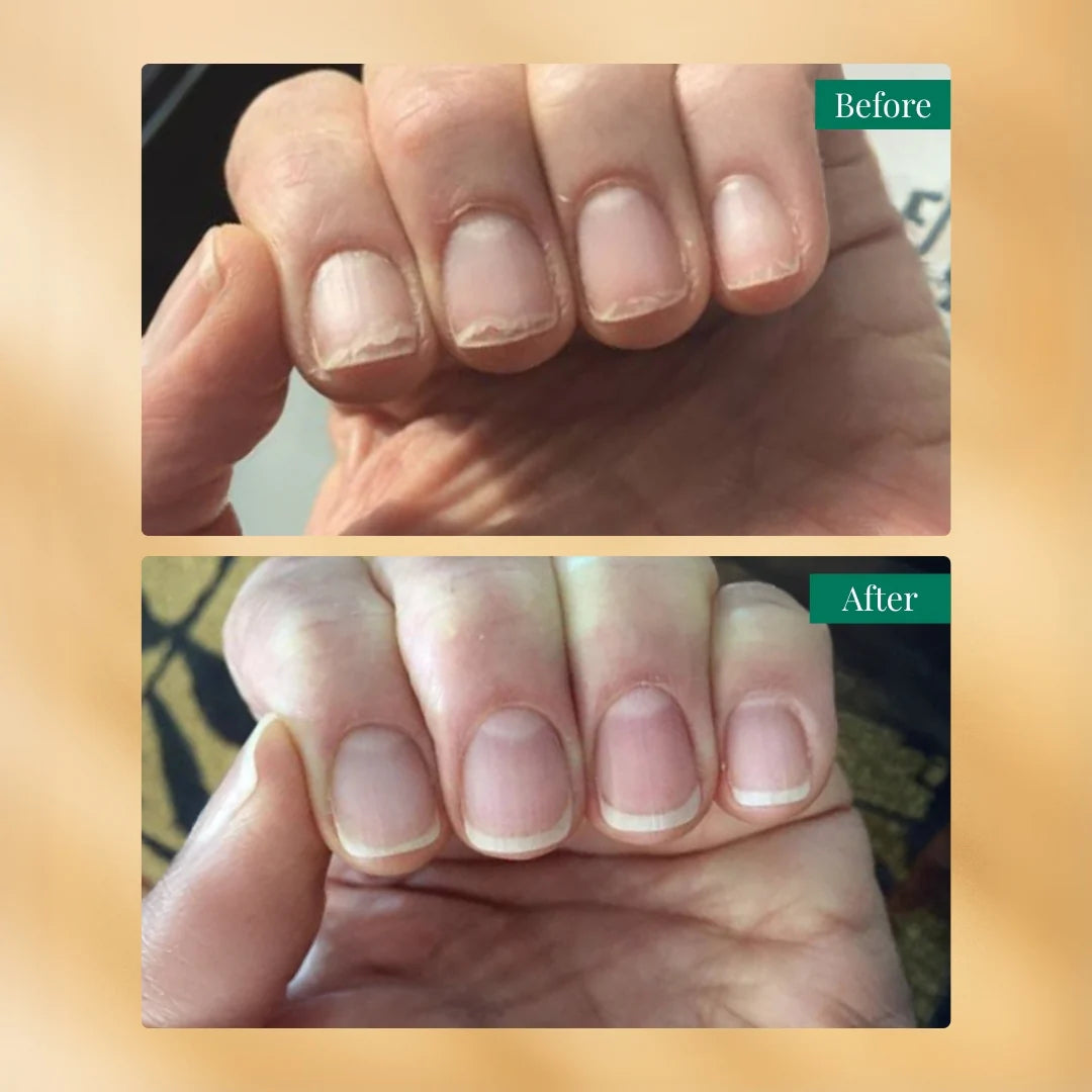 RAS Luxury Oils Nailchemy™ Sérum fortifiant pour les ongles - 65,7g